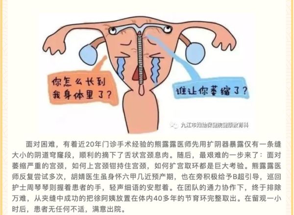 妇女节（妇女节育环不摘可以吗）